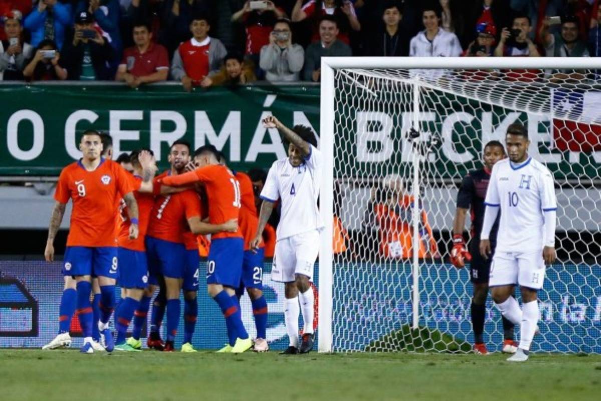 Honduras cayó derrotada en Temucho ante Chile (4 - 1), con un pésimo arbitraje del peruano Michael Espinoza. Foto/AFP