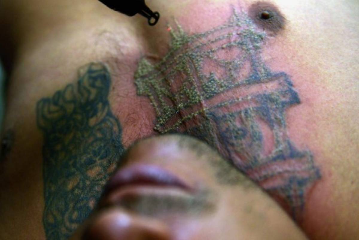 Expandilleros salvadoreños buscan eliminar tatuajes para borrar estigmas