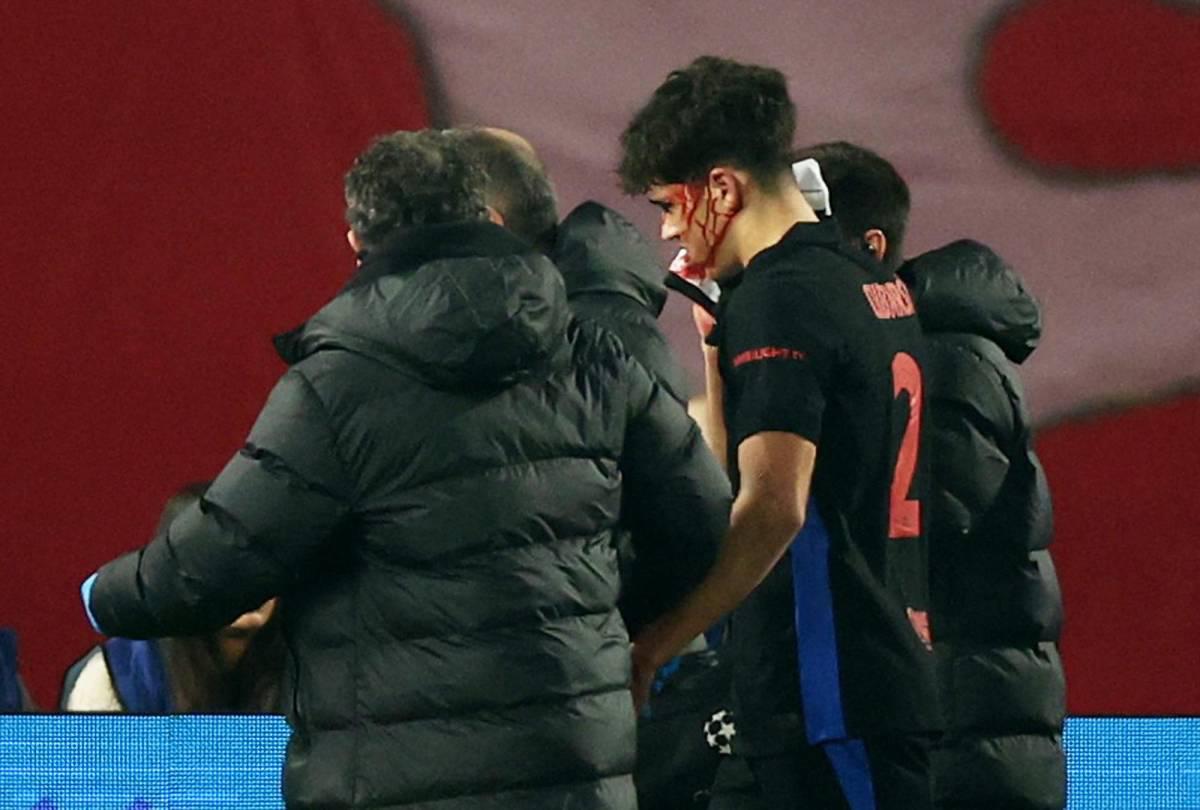 Fuertes imágenes: así quedó la cara de Pau Cubarsí tras recibir patada en Champions League