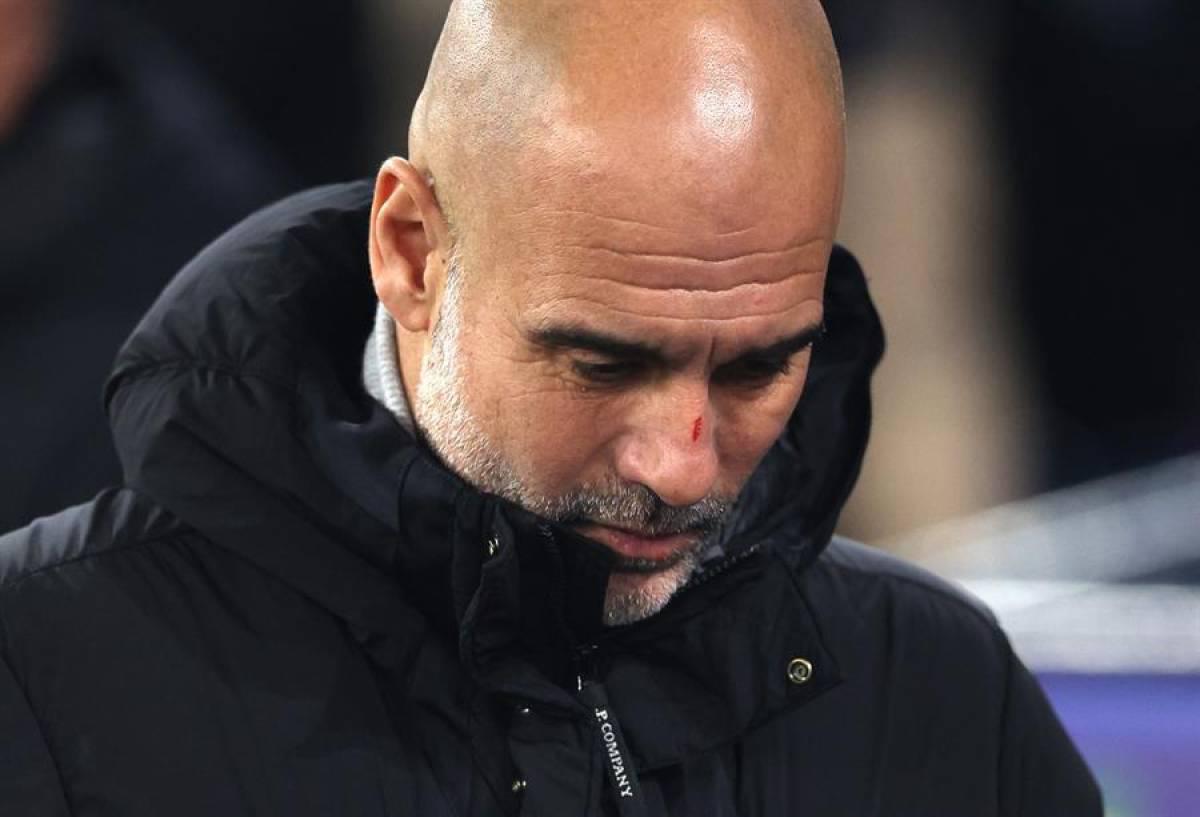 Pleito entre hinchas de Feyenoord y Manchester City: ¿Qué le pasó a Pep Guardiola en el rostro?