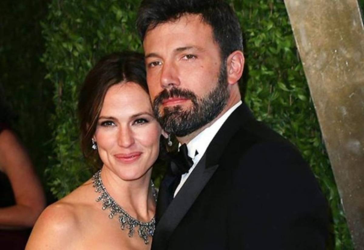 ¿Qué le pasó en la cara a Ben Affleck? ¿El actor se operó el rostro? (FOTOS)