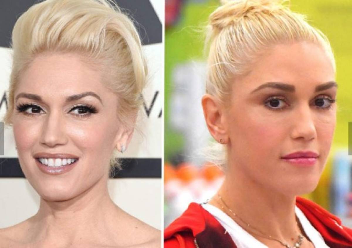 Gwen Stefani luce irreconocible y muchos creen que es efecto del botox