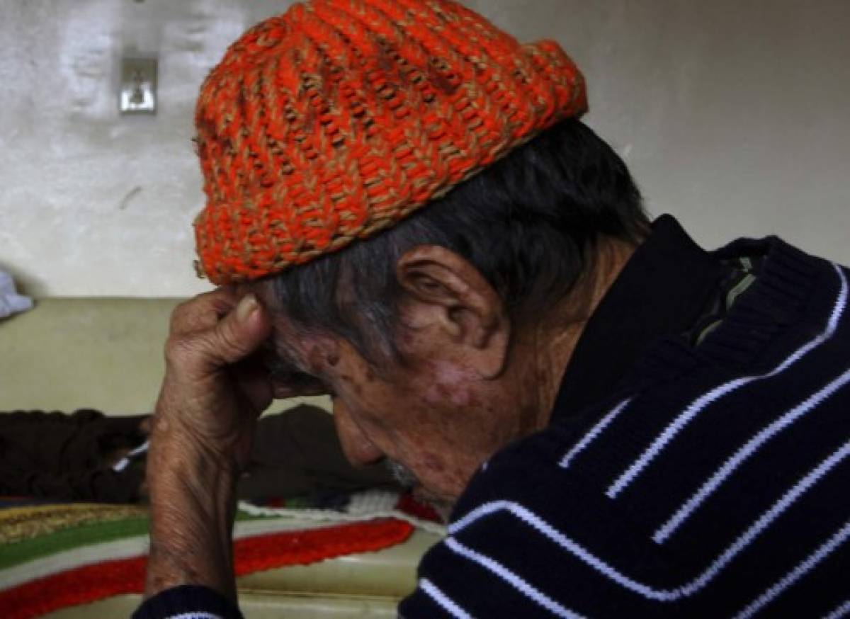 Honduras, afectado por el Alzheimer