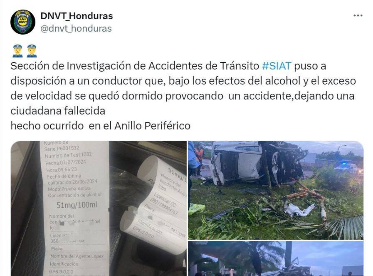 Conductor de vehículo de accidente en el anillo periférico se encuentra estable, según Hospital Escuela