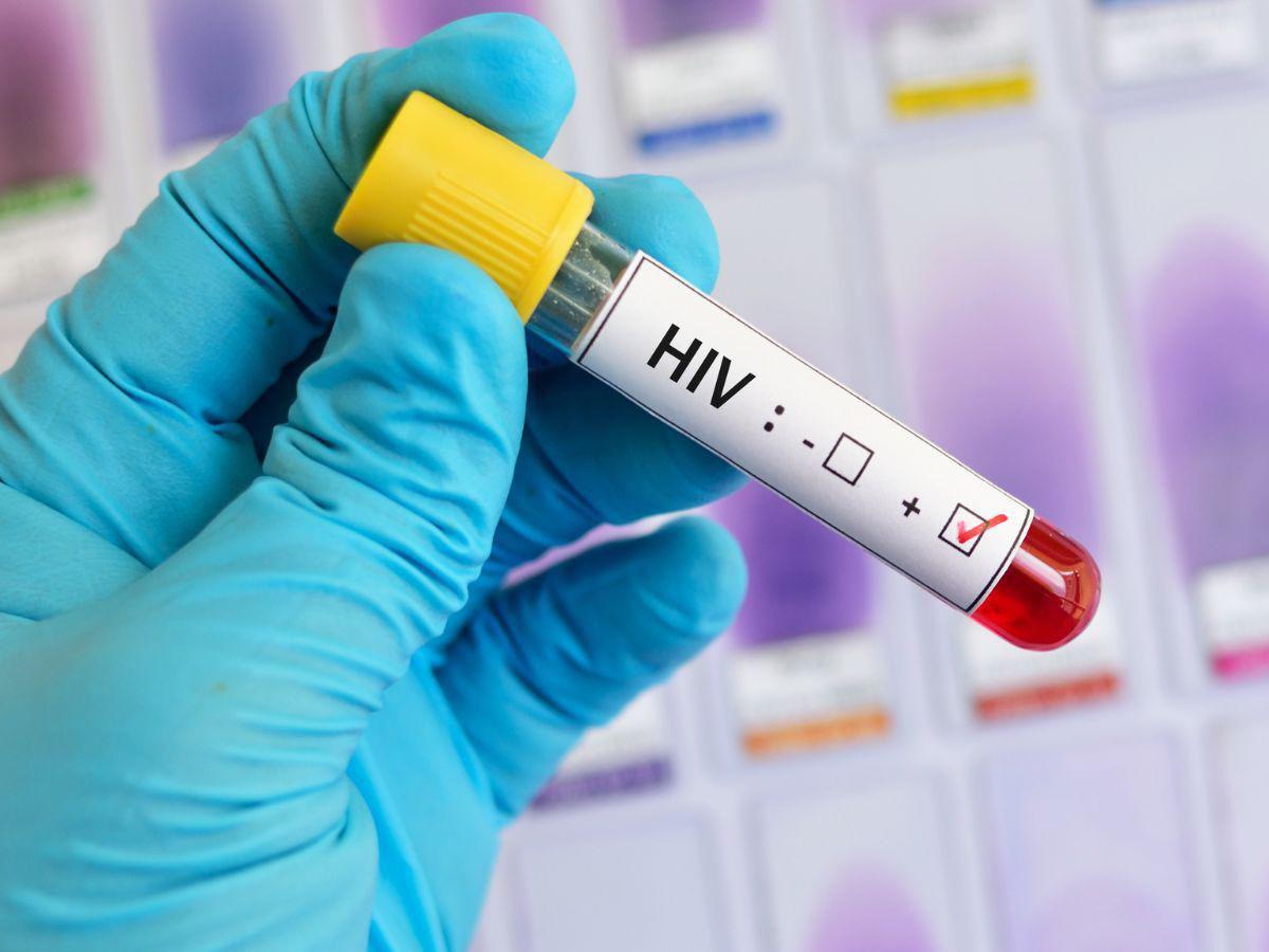 El Conadeh registra más de 900 casos de VIH en 2023