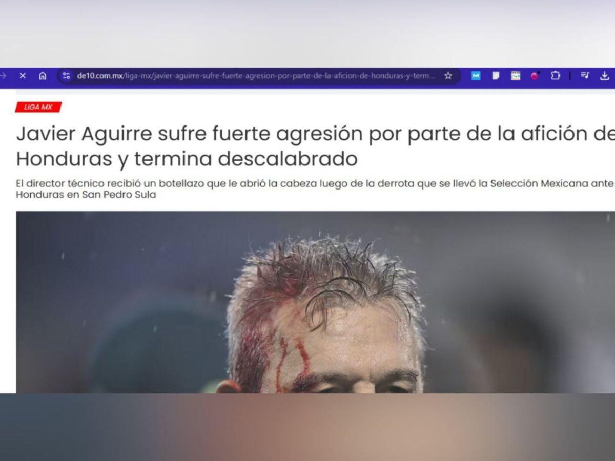 Prensa mexicana condena la agresión contra Javier Aguirre y aceptan amarga derrota