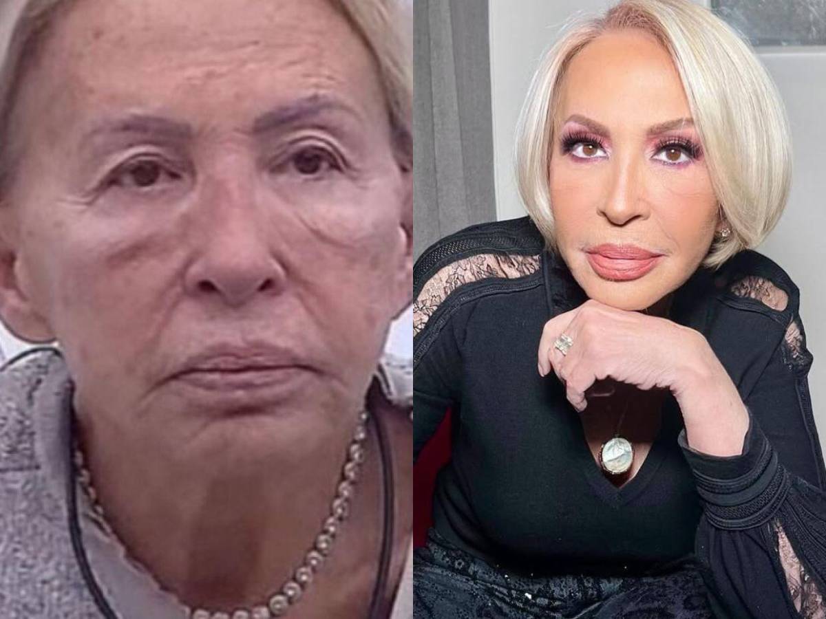 Doctor de Laura Bozzo revela los detalles que le hizo en el rostro