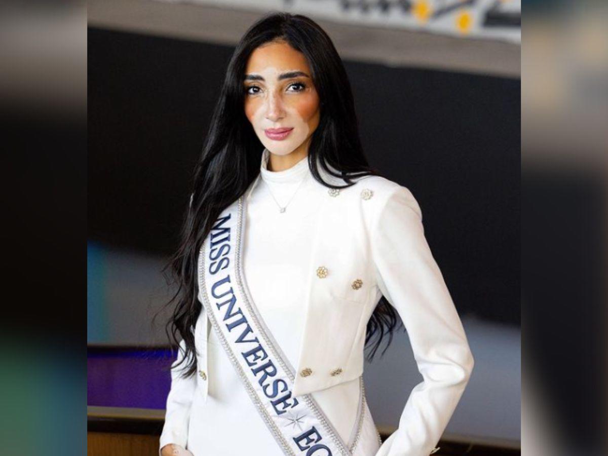 Logina Salah, la primera Miss Egipto con vitiligo, busca coronarse en el Miss Universo 2024