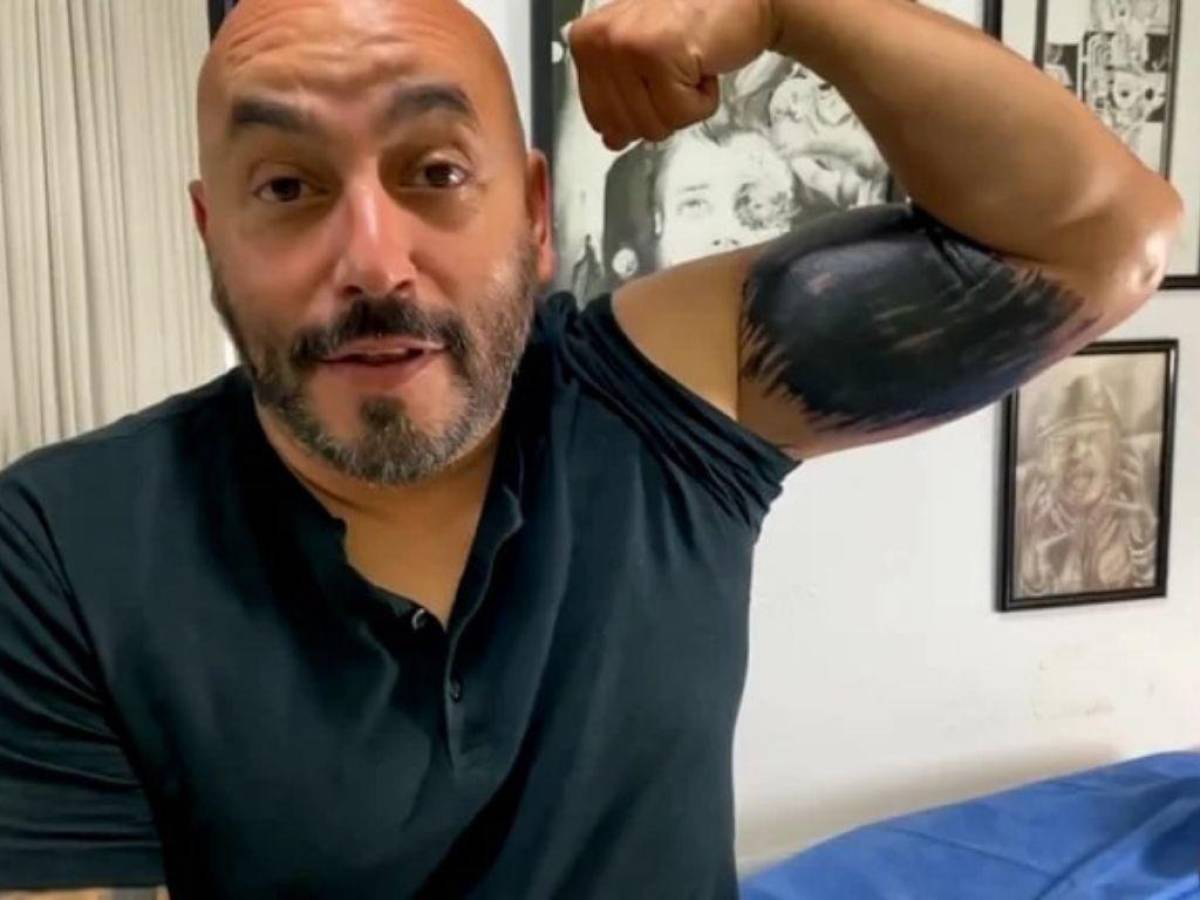 Lupillo fue objeto de memes por su manchón negro en el brazo.