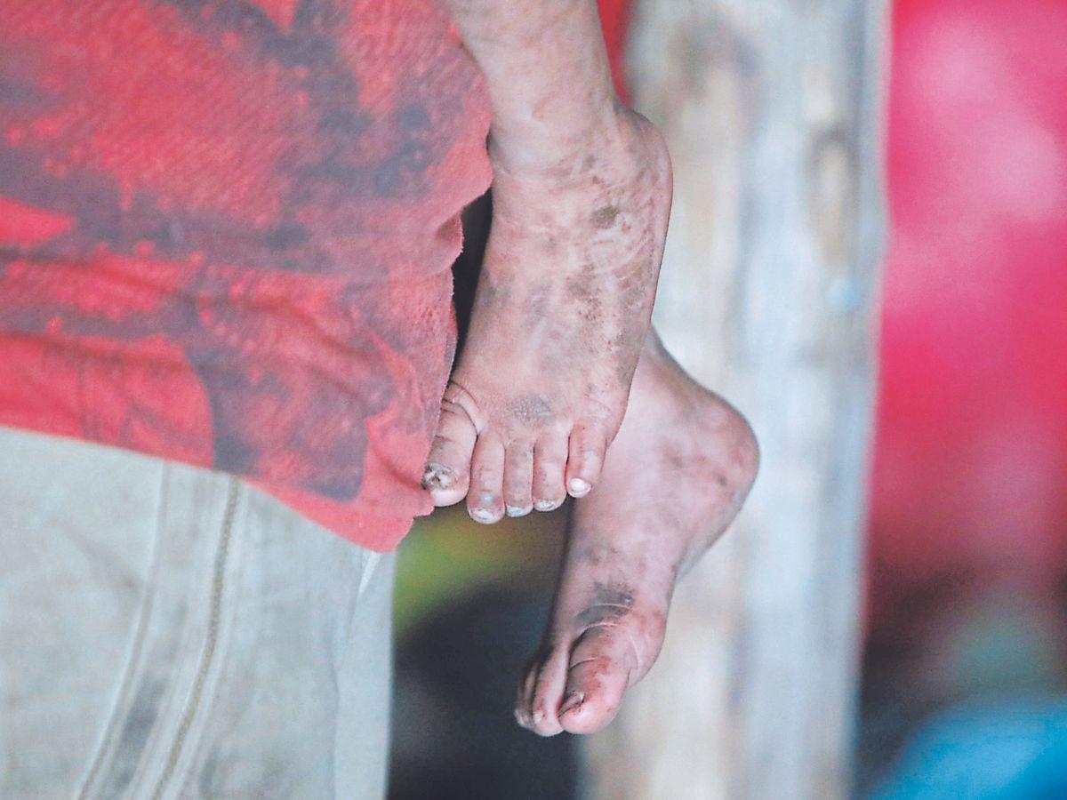 Los niños ni zapatos tienen para poder caminar.