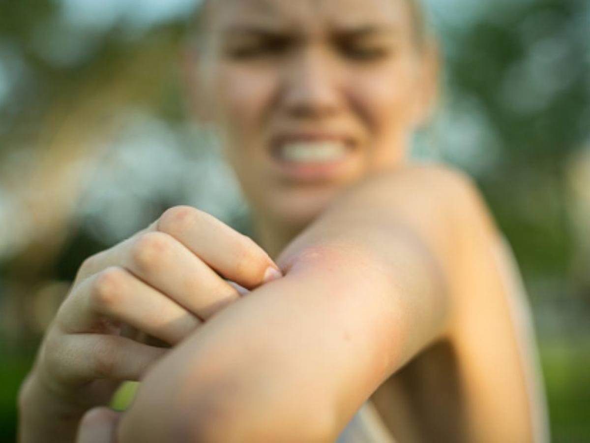 Tres remedios caseros para ahuyentar a los mosquitos este verano