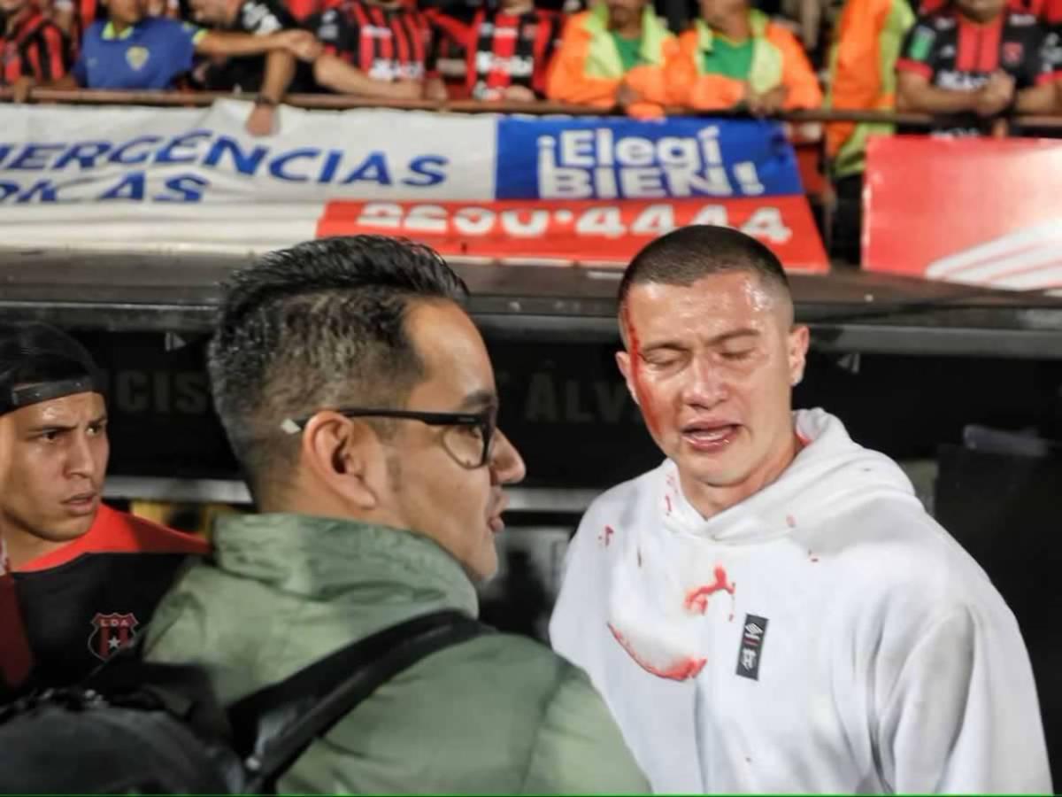 ¡Puñetazos! Tremendo zafarrancho que se armó en final Alajuelense ante Herediano