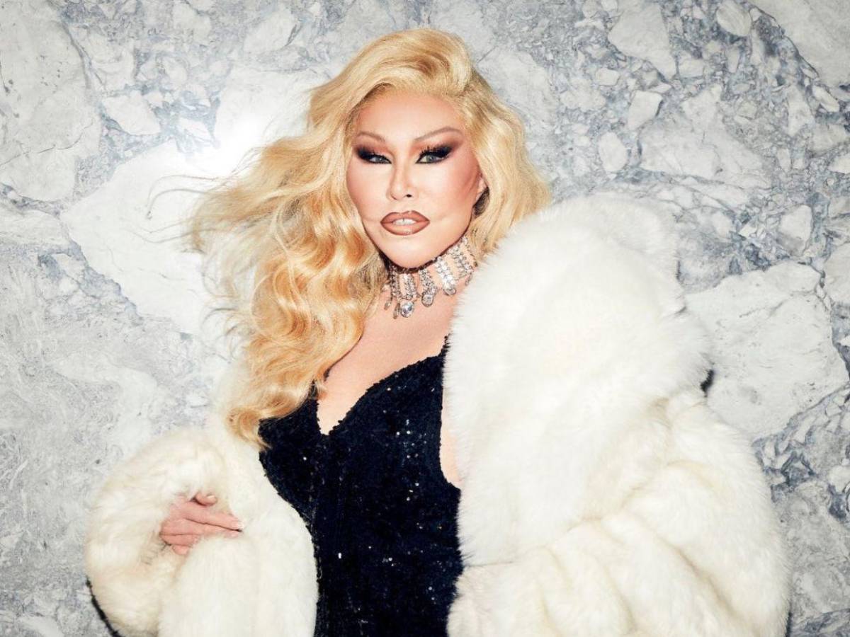 ¿De qué murió Jocelyn Wildenstein, conocida como la “mujer gata”?