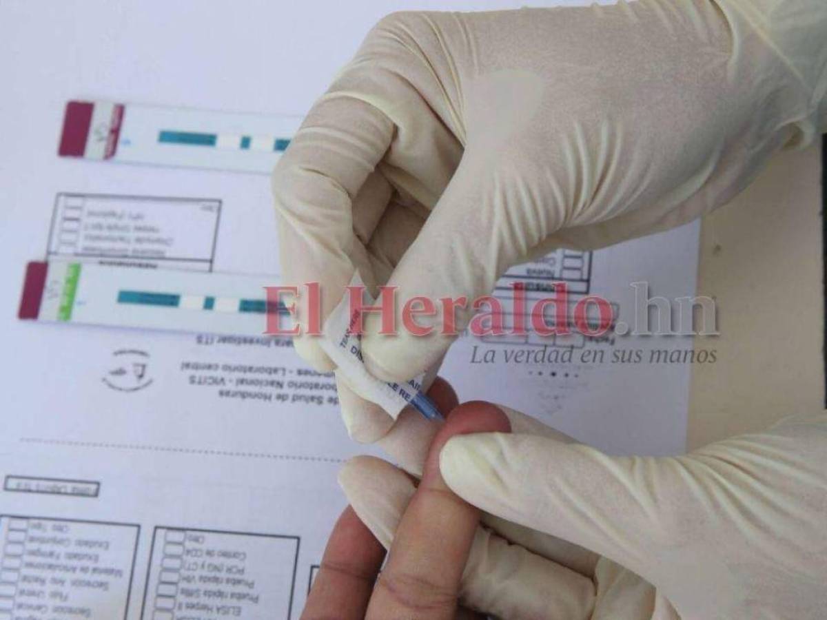 Se reportan casi 1,000 casos de hepatitis aguda en el mundo