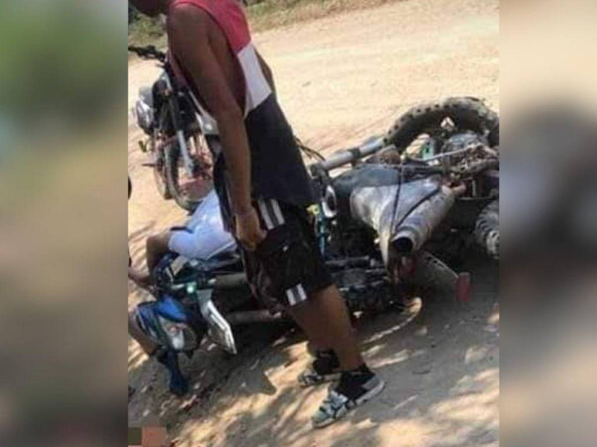 Un muerto y dos heridos deja aparatoso choque de motocicletas en Santa Bárbara