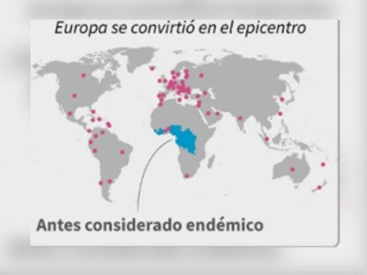 El mapa muestra la distribución de la viruela símica o viruela del mono.