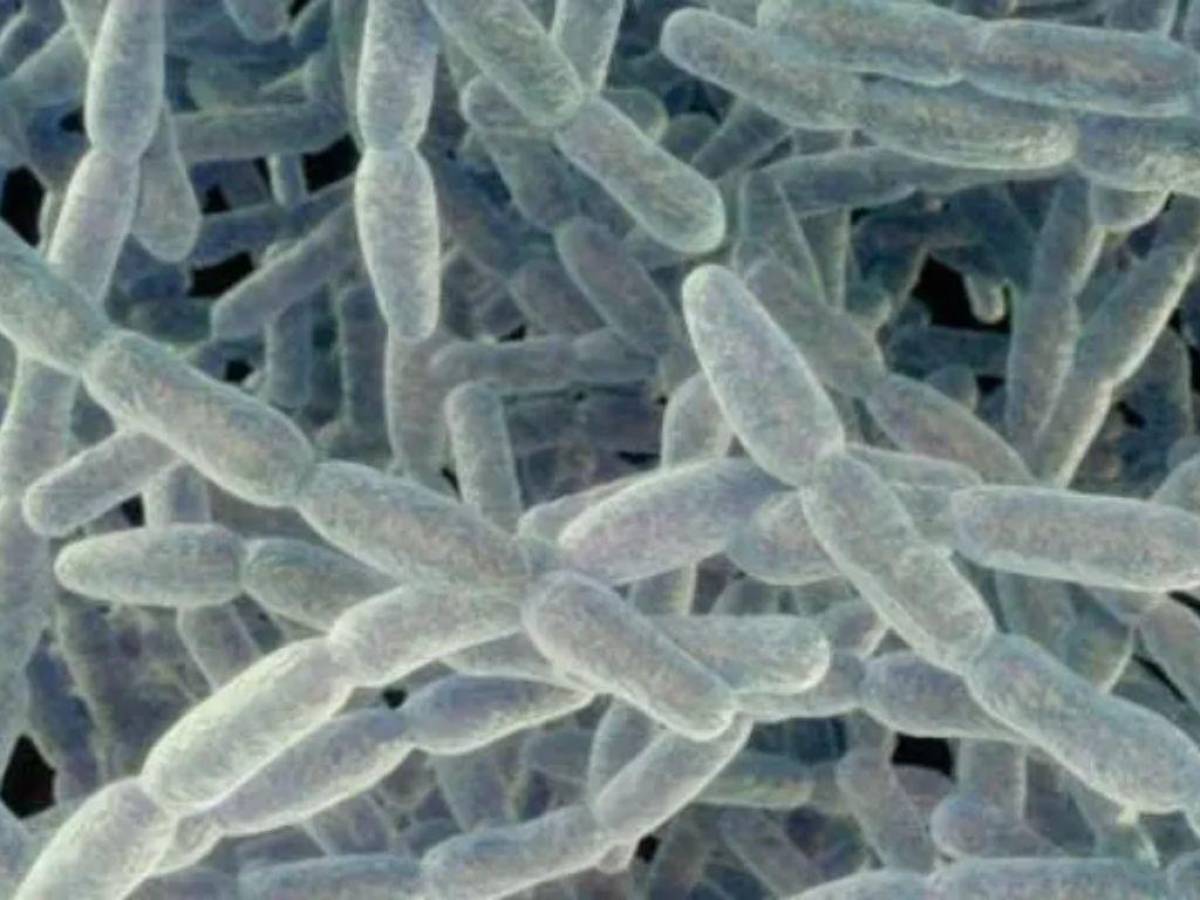 ¿La bacteria legionella es la causa de brote de neumonía con 4 muertos en Argentina?