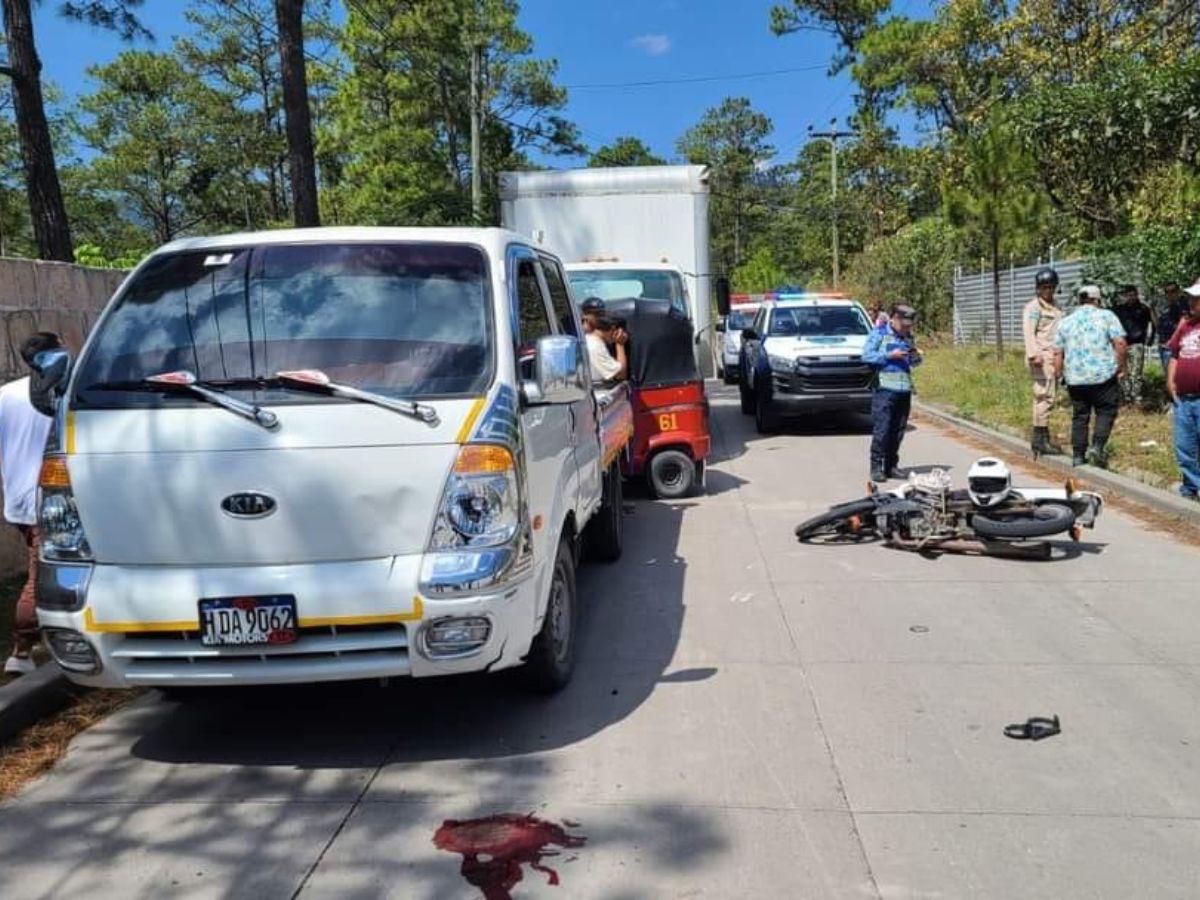 Motociclista muere tras chocar contra camión en Valle de Ángeles