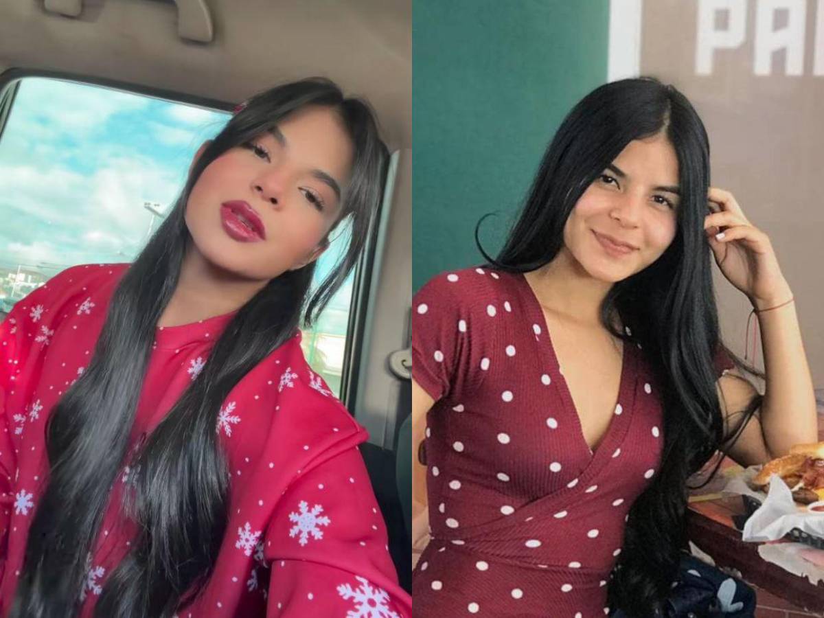 ¿Alisson Mejía se hizo un procedimiento estético en los labios? Mira su cambio de imagen