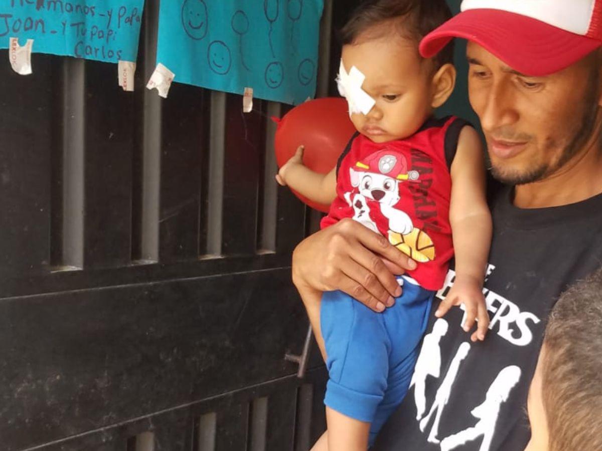 Padres piden ayuda para que su hijo no pierda un ojo