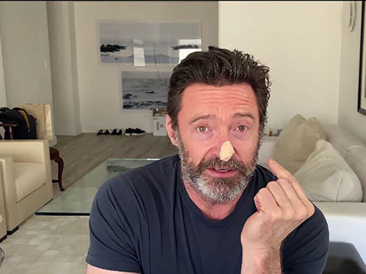 Cáncer de piel amenaza nuevamente a Hugh Jackman