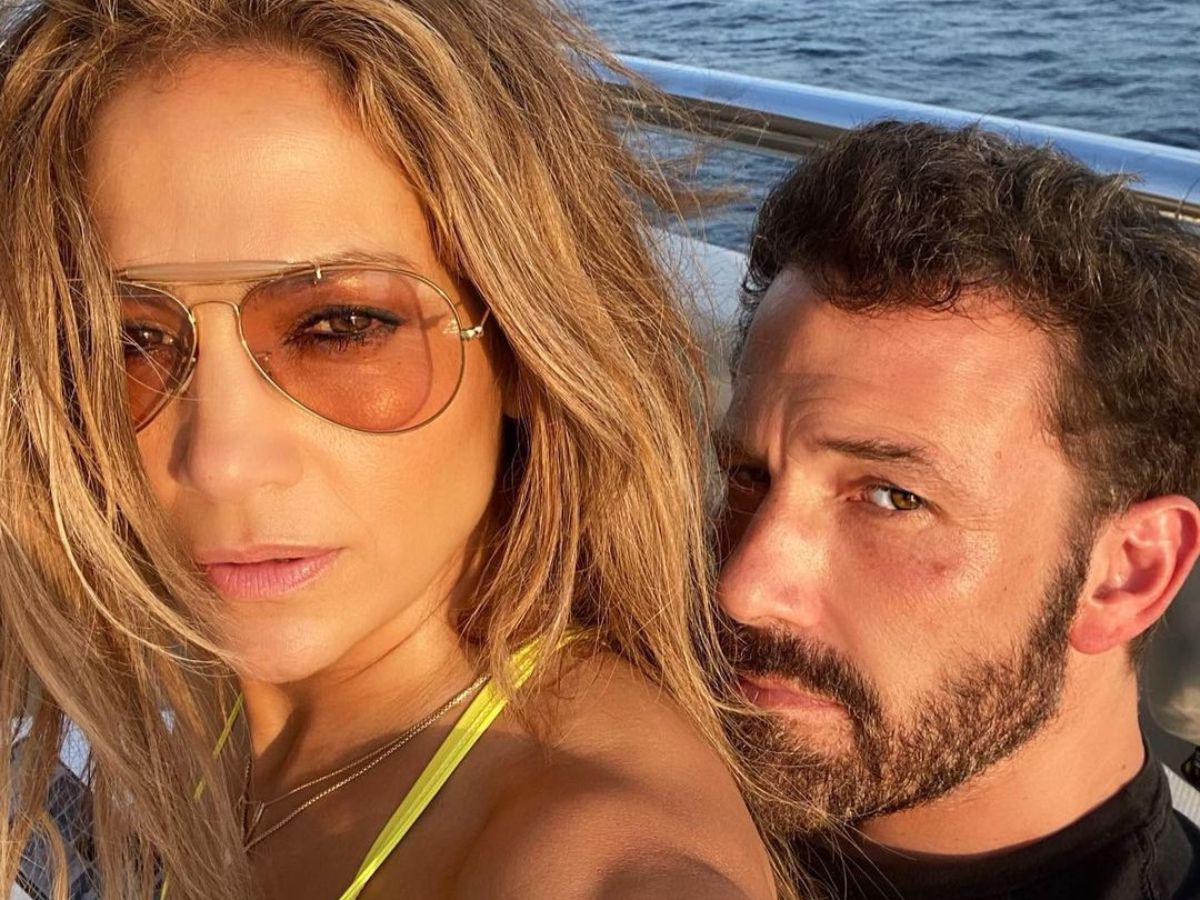 JLo se habría sometido a una cirugía para “recuperar su brillo” tras divorcio