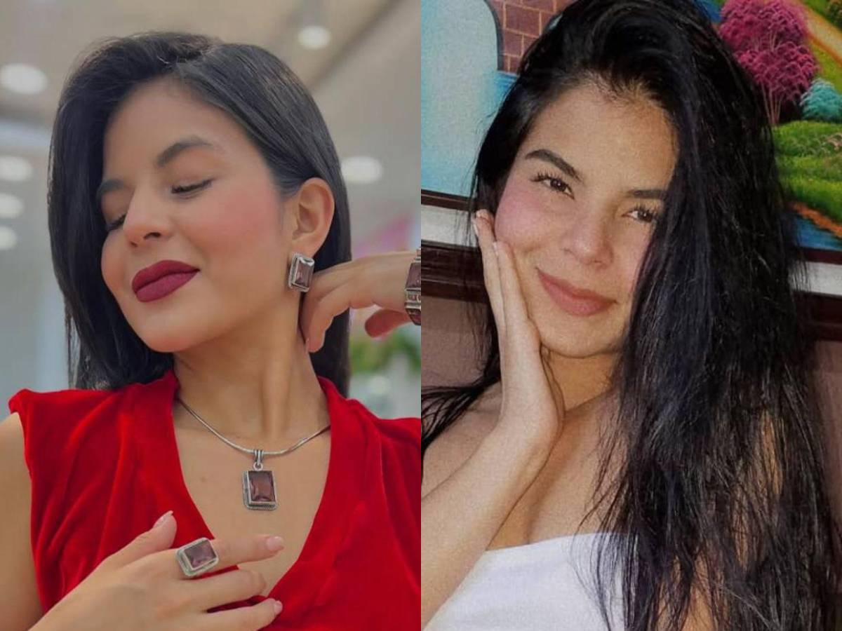 ¿Alisson Mejía se hizo un procedimiento estético en los labios? Mira su cambio de imagen