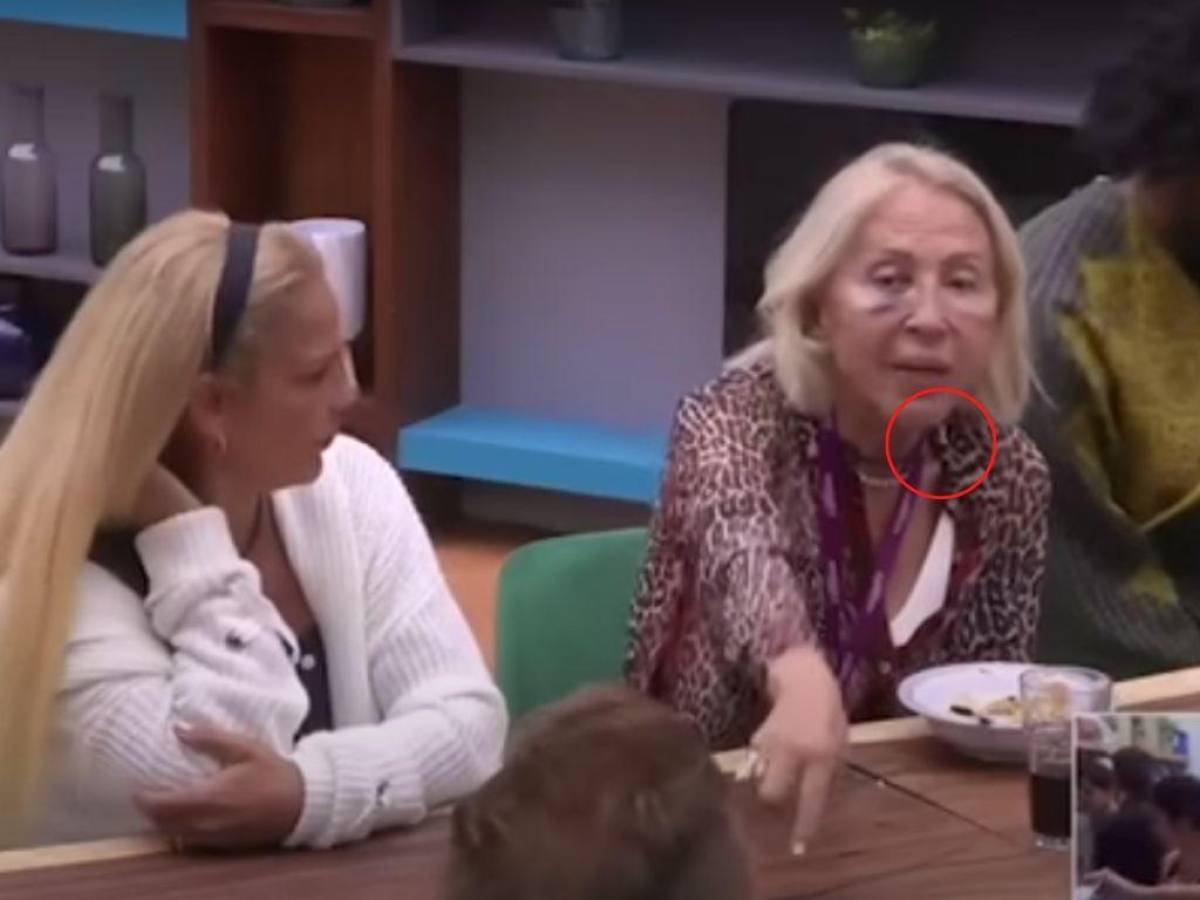 VIDEO: Laura Bozzo pierde un diente y así reacciona a las burlas