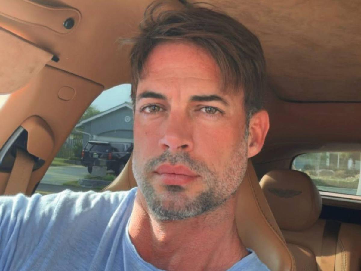 William Levy se somete a tratamiento estético: Esto se sabe