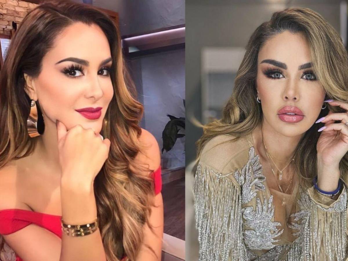 Ninel Conde: ¿Qué cirugías se ha hecho a lo largo de los años?