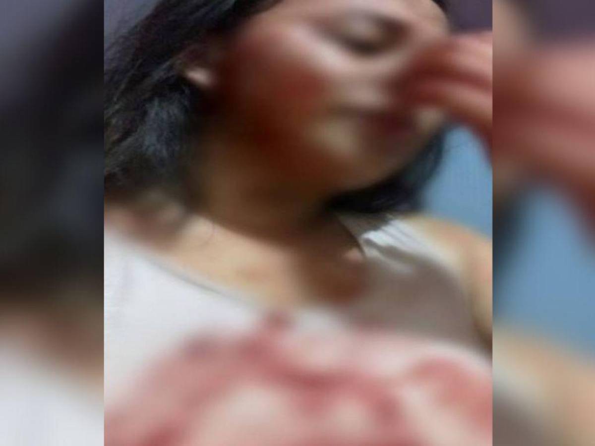 Joven y su madre escapan de la muerte tras brutal ataque