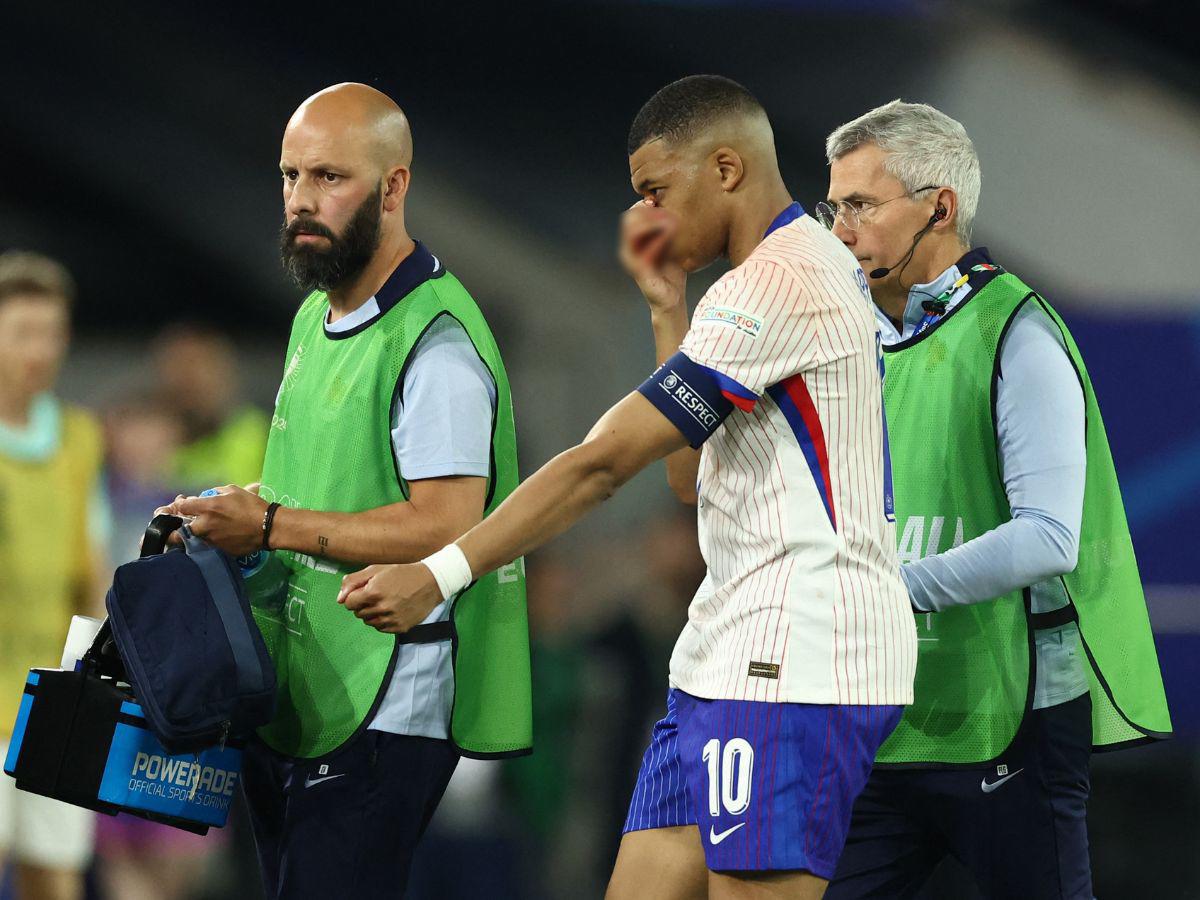 ¡Respira Francia! Kylian Mbappé no tendrá que someterse a operación