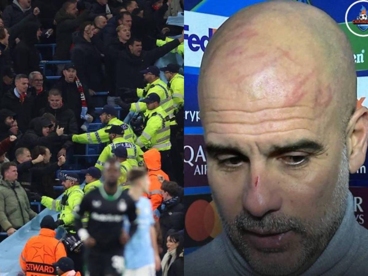 Pleito entre hinchas de Feyenoord y Manchester City: ¿Qué le pasó a Pep Guardiola en el rostro?