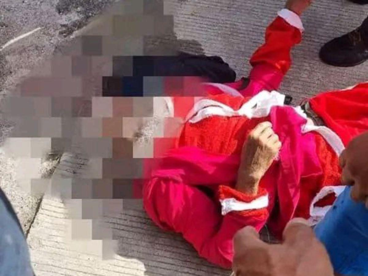 Hombre de la tercera edad vestido de Santa Claus fallece tras ser atropellado en Sabanagrande