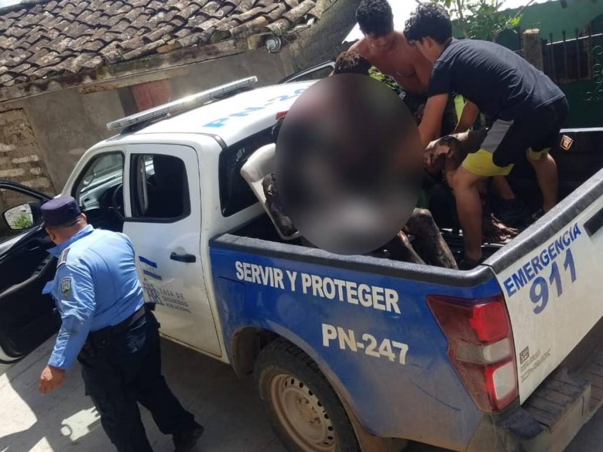 Dos de los lesionados tuvieron que ser sentados en sillas plásticas para poder movilizarlos en una patrulla debido a lo lastimada que estaba su piel.