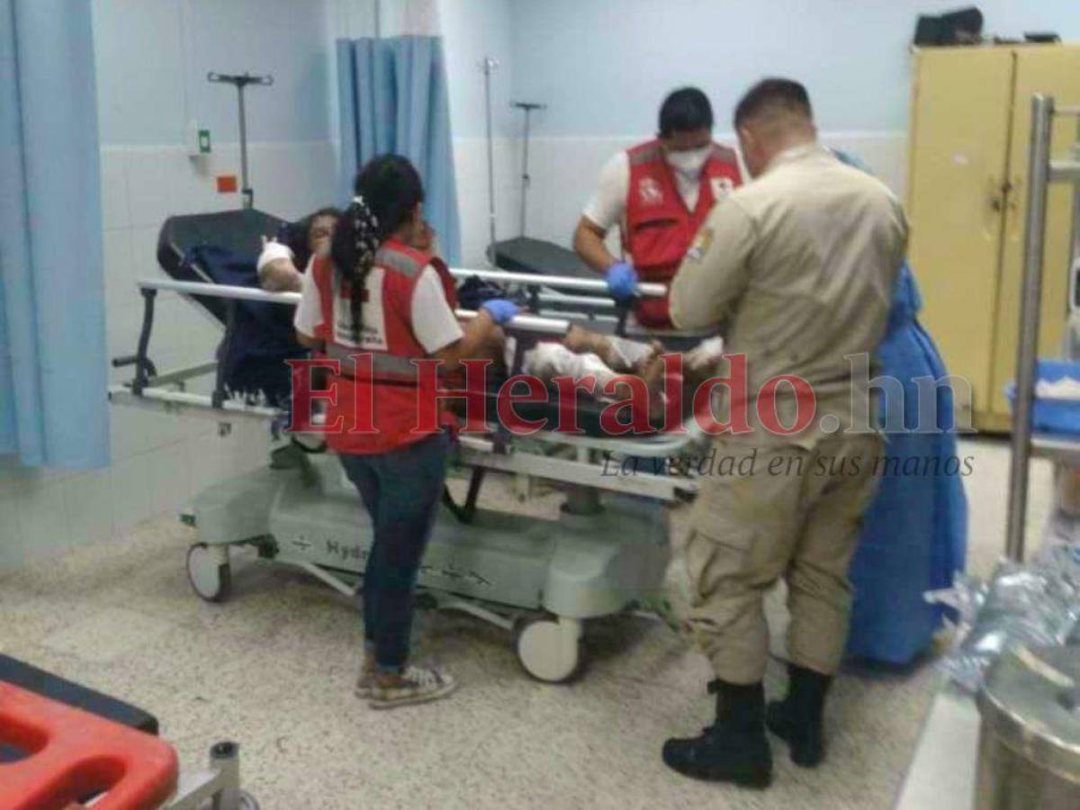 Estable mujer que se prendió fuego en Comayagua