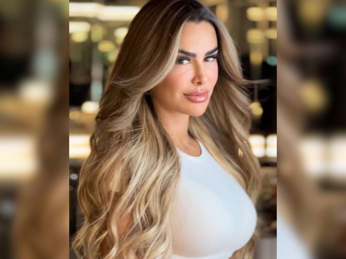 Nuevo retoque: ¿Qué se hizo Ninel Conde en el rostro?