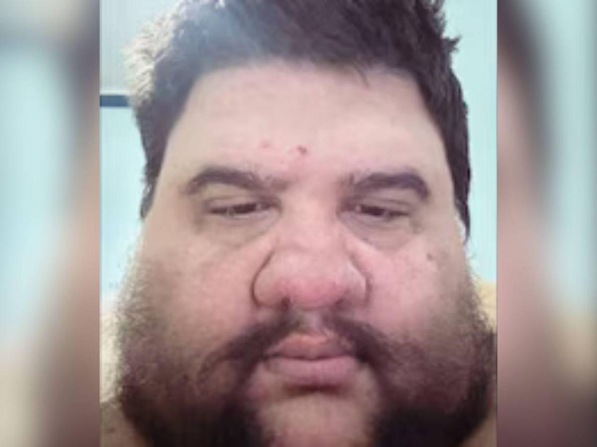 Muere Gabriel Freitas, el influencer brasileño que luchó contra la obesidad