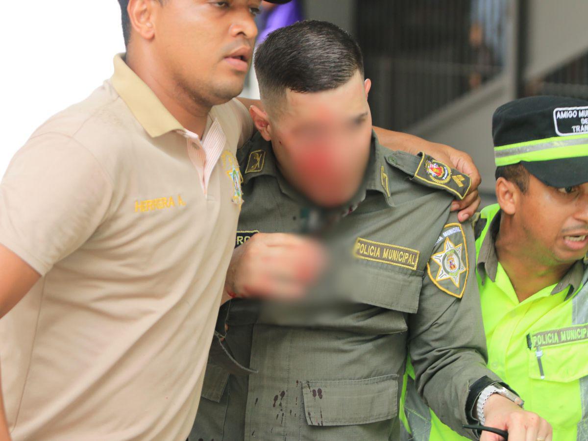 Uno de los policías heridos durante el zafarrancho.