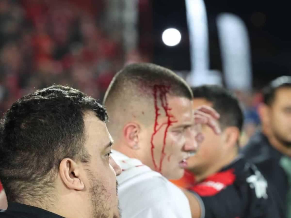 ¡Puñetazos! Tremendo zafarrancho que se armó en final Alajuelense ante Herediano