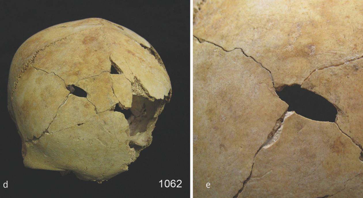 Descubren masacre y hasta canibalismo ceremonial en Edad de Bronce británica