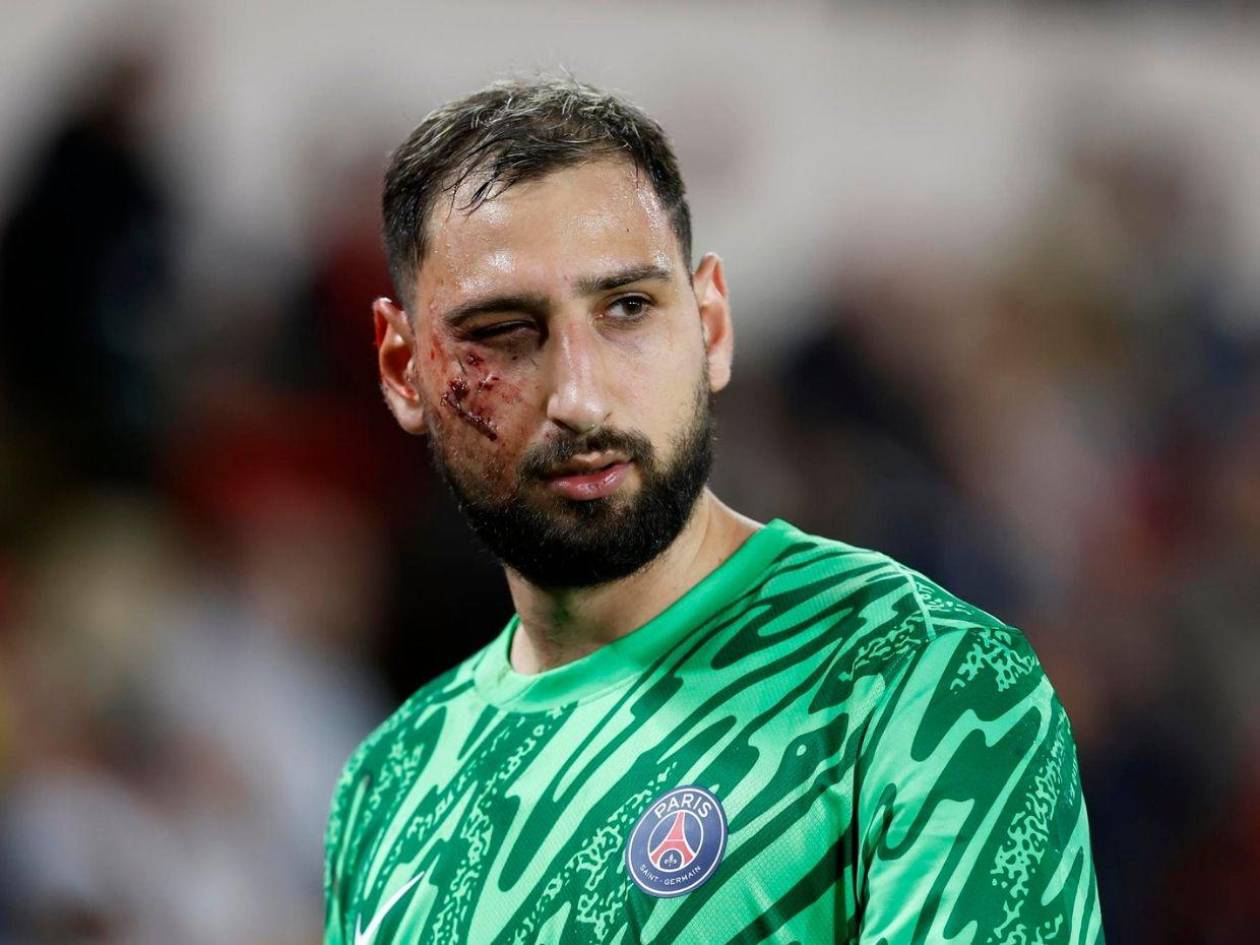 Video: Así fue la espantosa lesión que sufrió Donnarumma en su rostro