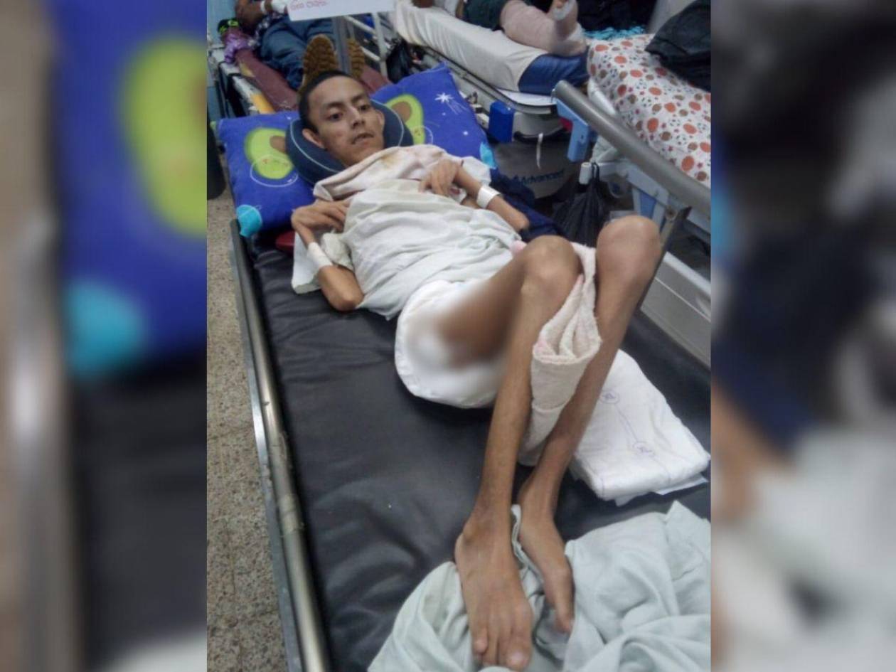 Niño con condición especial pide ayuda para volver a su pueblo, San Antonio de Flores