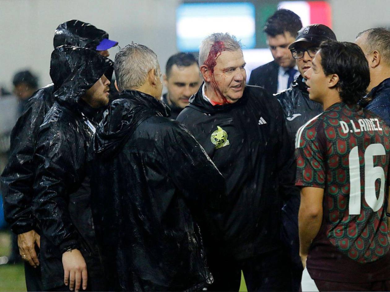 “Vasco” Aguirre se refiere a la agresión y la derrota ante Honduras