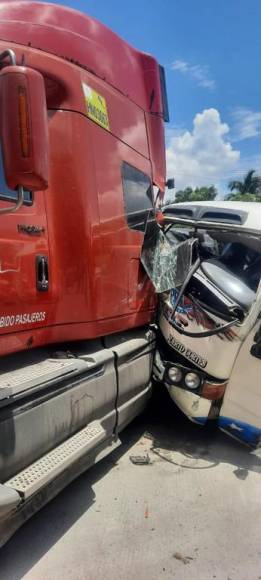 Personas atrapadas y más de 10 heridos: Fuertes imágenes del choque entre bus y rastra en Choloma