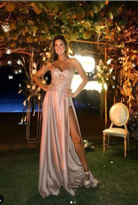 FOTOS: Daniella Álvarez, modelo que sufrió amputación del pie izquierdo