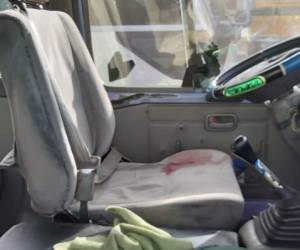 El asiento del conductor quedó manchado con la sangre del motorista. Foto: Cortesía