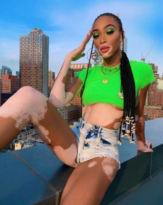 FOTOS: Winnie Harlow, la modelo que sería la nueva novia de Maluma