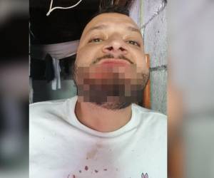 Los policías militaron propinaron una salvaje golpiza a uno de los privados de libertad.