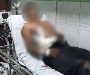 El agente policial recibió atención médica en Comayagua.